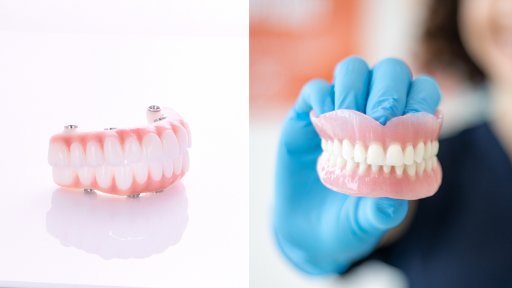 Dentures vs. Dental Implants: Which is Right for You?