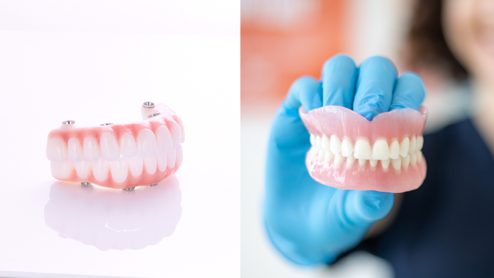 Are dentures or dental implants the better option for your teeth replacement?